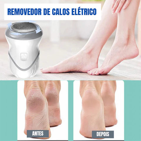 Removedor de Calos Elétrico - Lixa para pés